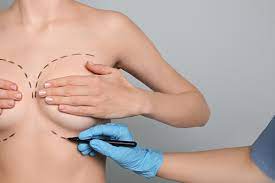 Effect of Body Image Satisfaction on Outcomes Among Women Undergoing Different Types of Breast Surgeries